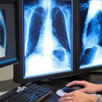 Basics About CE Courses Radiologic Technologist Students Should Know